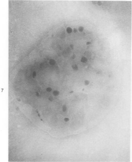 https://cdn.ncbi.nlm.nih.gov/pmc/blobs/529b/2032131/03ff8bac66a8/amjpathol00400-0174-b.jpg