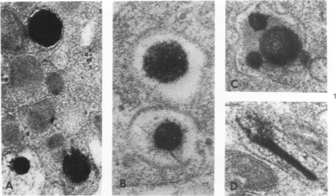 https://cdn.ncbi.nlm.nih.gov/pmc/blobs/529b/2032131/0bccebf5a3a1/amjpathol00400-0171-a.jpg