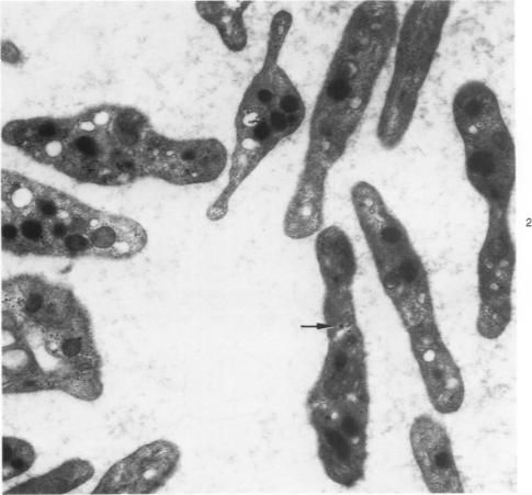 https://cdn.ncbi.nlm.nih.gov/pmc/blobs/529b/2032131/ef84095dae1f/amjpathol00400-0171-b.jpg