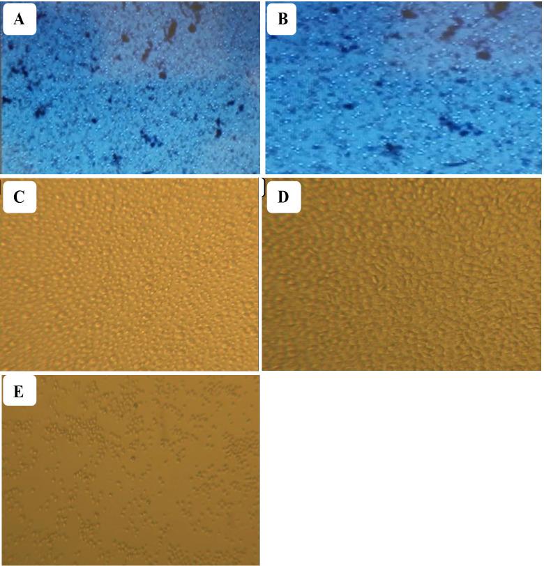 https://cdn.ncbi.nlm.nih.gov/pmc/blobs/529f/11914910/dcb2496a16ed/fimmu-16-1513443-g004.jpg