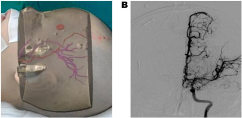https://cdn.ncbi.nlm.nih.gov/pmc/blobs/529f/12320074/76d9c1e8b734/gr6.jpg