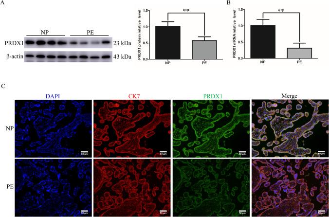 https://cdn.ncbi.nlm.nih.gov/pmc/blobs/52a6/10352211/6ba5d70c53ba/10815_2023_2820_Fig1_HTML.jpg