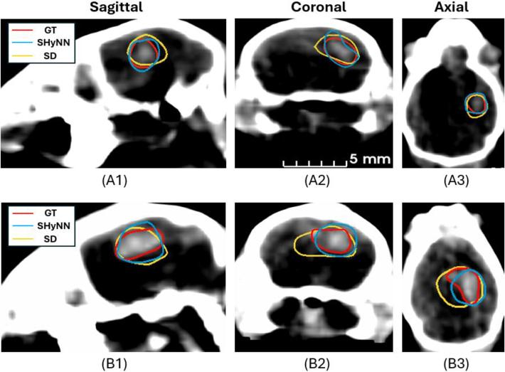 https://cdn.ncbi.nlm.nih.gov/pmc/blobs/52a6/11563333/2d7ebf685fe5/boe-15-11-6211-g007.jpg