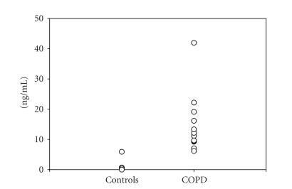 https://cdn.ncbi.nlm.nih.gov/pmc/blobs/52a6/2246041/c11849790ab4/CDI2007-52040.002.jpg