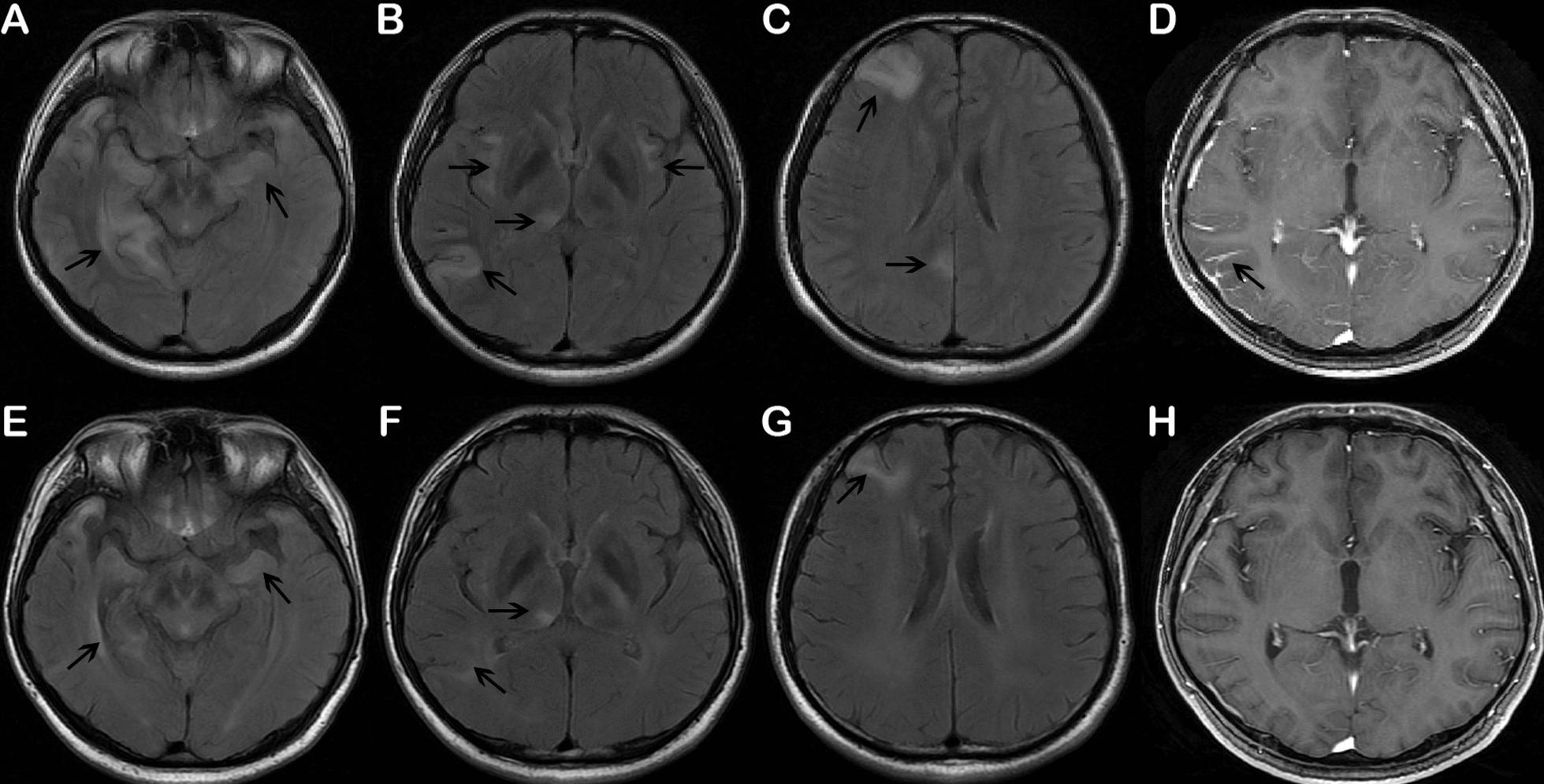 https://cdn.ncbi.nlm.nih.gov/pmc/blobs/52a9/8958775/58feda0ed63a/40001_2022_676_Fig1_HTML.jpg