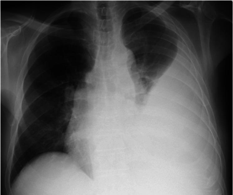 https://cdn.ncbi.nlm.nih.gov/pmc/blobs/52aa/11563777/ddfa32f8e605/cureus-0016-00000071520-i03.jpg