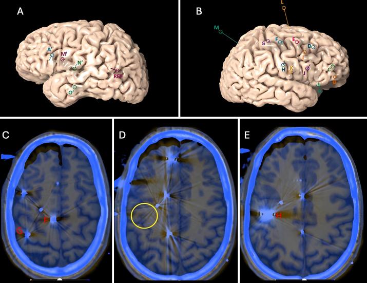 https://cdn.ncbi.nlm.nih.gov/pmc/blobs/52ab/12036357/500fa7981f6f/CASE24667_figure_1.jpg