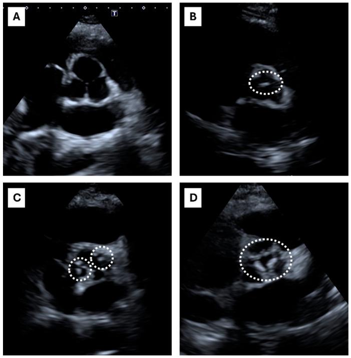https://cdn.ncbi.nlm.nih.gov/pmc/blobs/52ae/11943964/d0b9480b0c9d/life-15-00506-g001.jpg