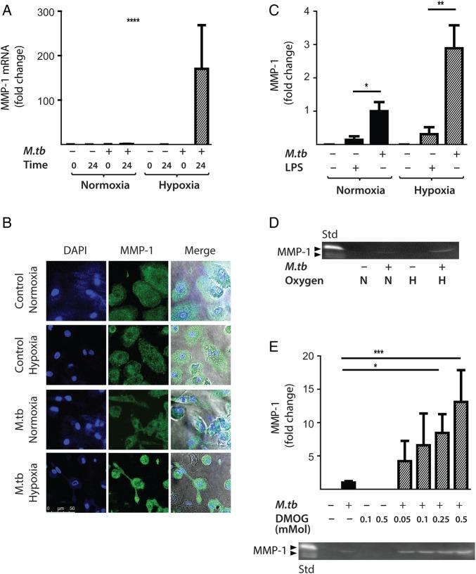 https://cdn.ncbi.nlm.nih.gov/pmc/blobs/52b2/5136721/1f10e7aaa9d9/thoraxjnl-2015-207402f03.jpg