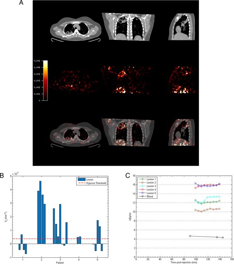 https://cdn.ncbi.nlm.nih.gov/pmc/blobs/52b2/5136721/659844790fbe/thoraxjnl-2015-207402f02.jpg