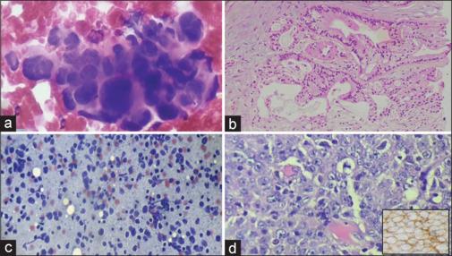 https://cdn.ncbi.nlm.nih.gov/pmc/blobs/52b3/11108040/899a98215bdd/JCytol-41-123-g002.jpg
