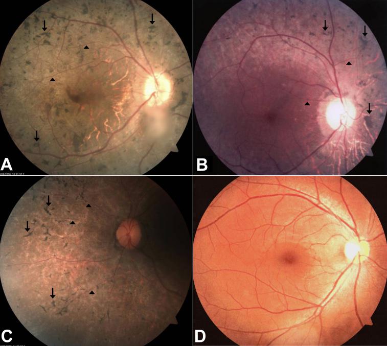 https://cdn.ncbi.nlm.nih.gov/pmc/blobs/52b4/3472925/08ccaf81d868/mv-v18-2411-f2.jpg