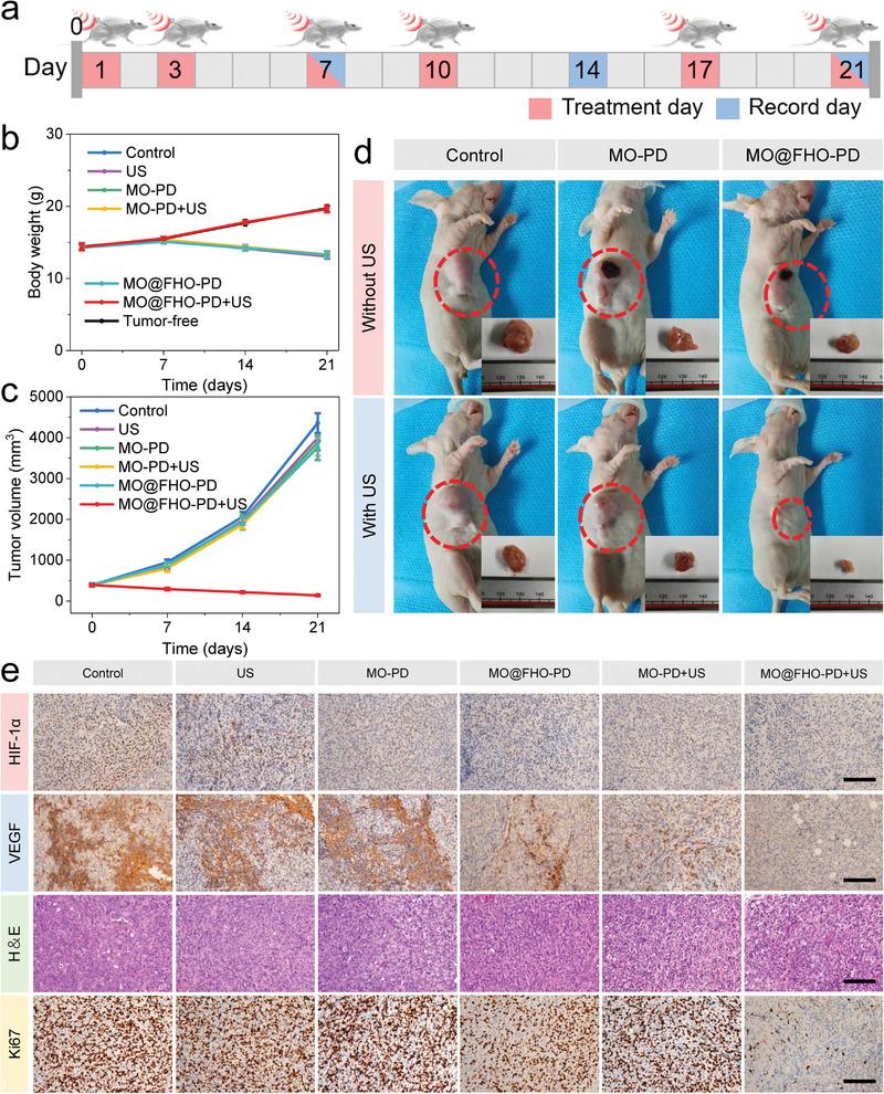 https://cdn.ncbi.nlm.nih.gov/pmc/blobs/52be/9189684/56268cae3115/ADVS-9-2200005-g005.jpg