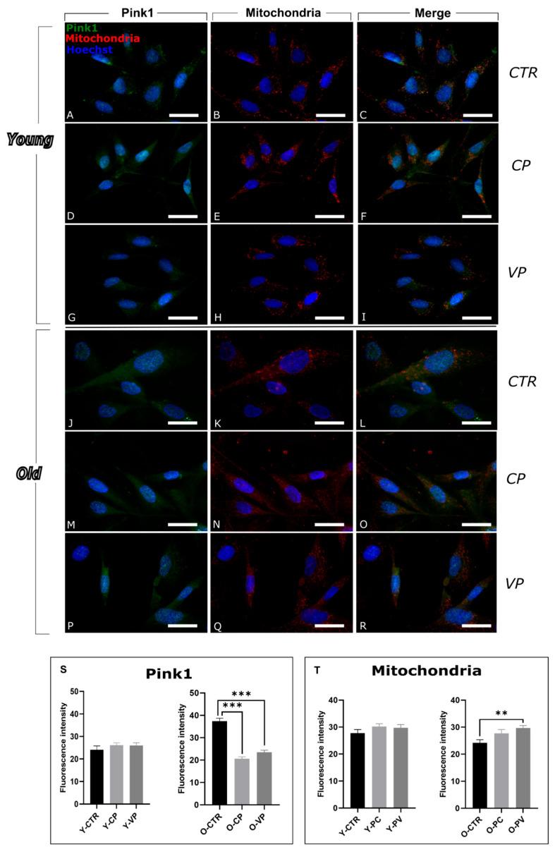 https://cdn.ncbi.nlm.nih.gov/pmc/blobs/52c7/12251965/ffcb8abedd15/nutrients-17-02147-g004.jpg