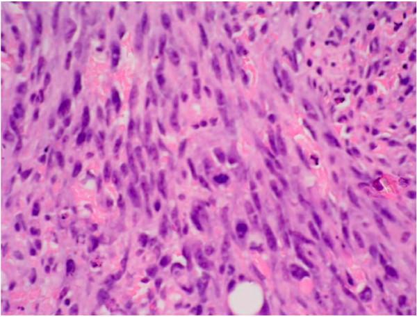https://cdn.ncbi.nlm.nih.gov/pmc/blobs/52ca/1570350/e583fecf3713/1477-7800-3-26-4.jpg