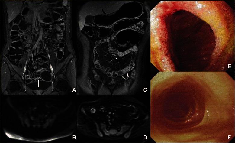 https://cdn.ncbi.nlm.nih.gov/pmc/blobs/52d0/4323053/3d23d2676321/12876_2015_235_Fig4_HTML.jpg