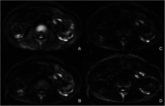 https://cdn.ncbi.nlm.nih.gov/pmc/blobs/52d0/4323053/5d0eec06ce13/12876_2015_235_Fig3_HTML.jpg