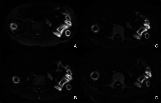 https://cdn.ncbi.nlm.nih.gov/pmc/blobs/52d0/4323053/c3e6f236e9e1/12876_2015_235_Fig2_HTML.jpg