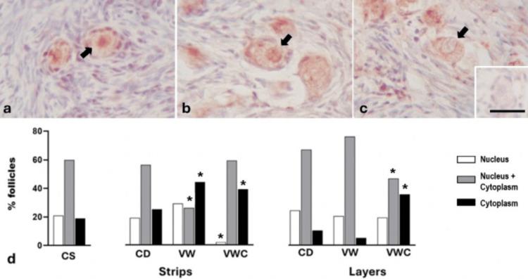 https://cdn.ncbi.nlm.nih.gov/pmc/blobs/52d3/12202021/e1762ec5d714/cureus-0017-00000084918-i05.jpg