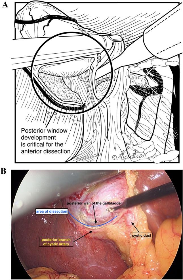https://cdn.ncbi.nlm.nih.gov/pmc/blobs/52d3/8116291/f0659d40d419/464_2020_8281_Fig3_HTML.jpg