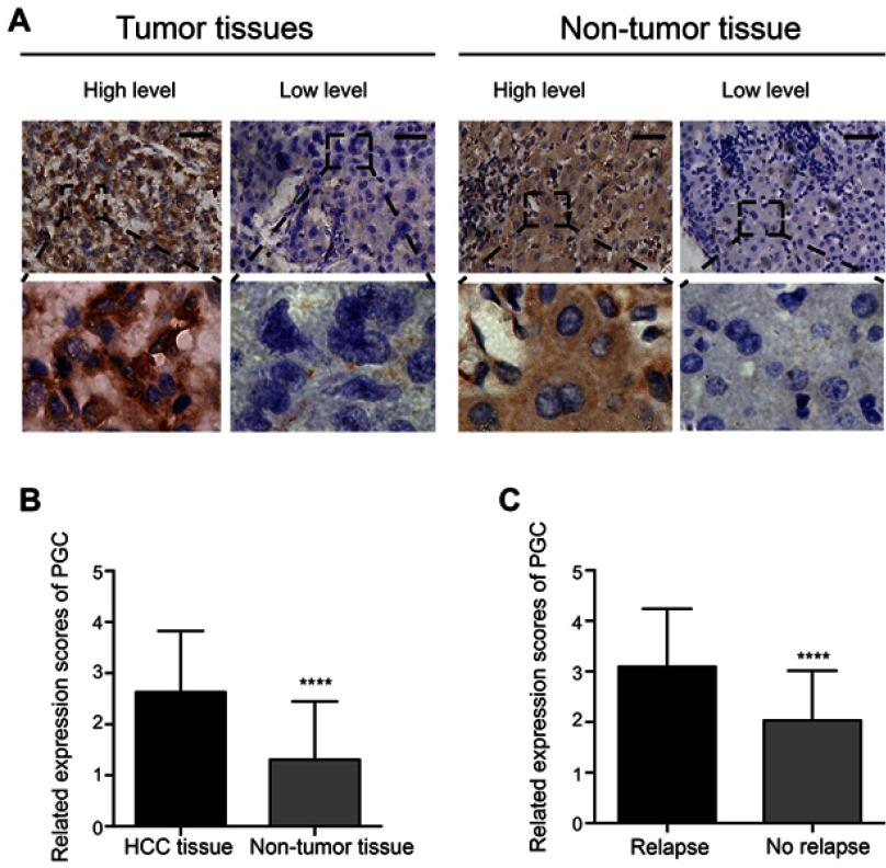 https://cdn.ncbi.nlm.nih.gov/pmc/blobs/52e3/6497866/8217723472d8/CMAR-11-2927-g0001.jpg