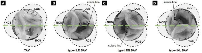 https://cdn.ncbi.nlm.nih.gov/pmc/blobs/52e5/5285369/58b43ce23bb2/fphys-08-00044-g0001.jpg
