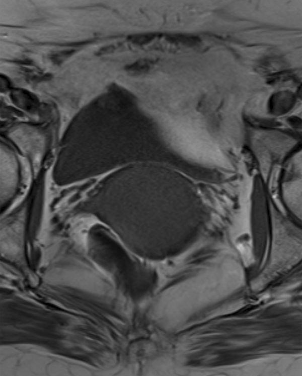 https://cdn.ncbi.nlm.nih.gov/pmc/blobs/52f1/6159299/340975a201ac/bjrcr.20160052.g001.jpg