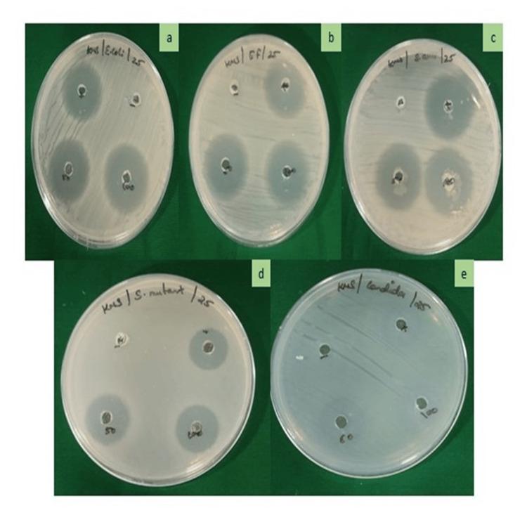 https://cdn.ncbi.nlm.nih.gov/pmc/blobs/52f2/11376470/19d679796839/cureus-0016-00000066296-i05.jpg