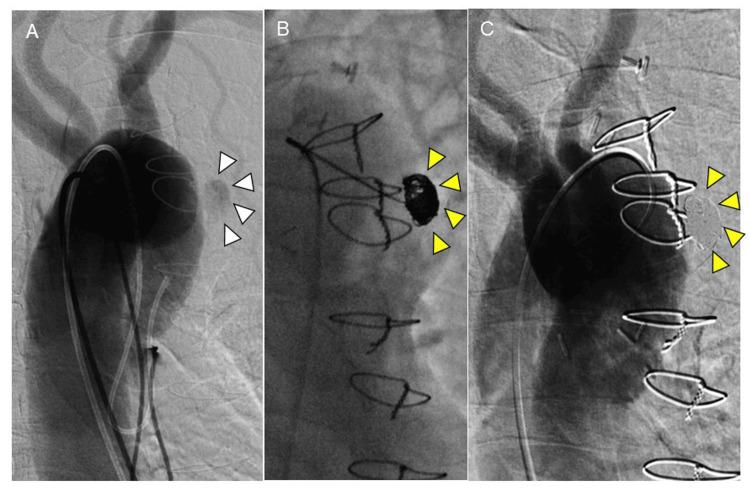 https://cdn.ncbi.nlm.nih.gov/pmc/blobs/52f3/11563729/a0b96accd2d1/cureus-0016-00000071559-i02.jpg