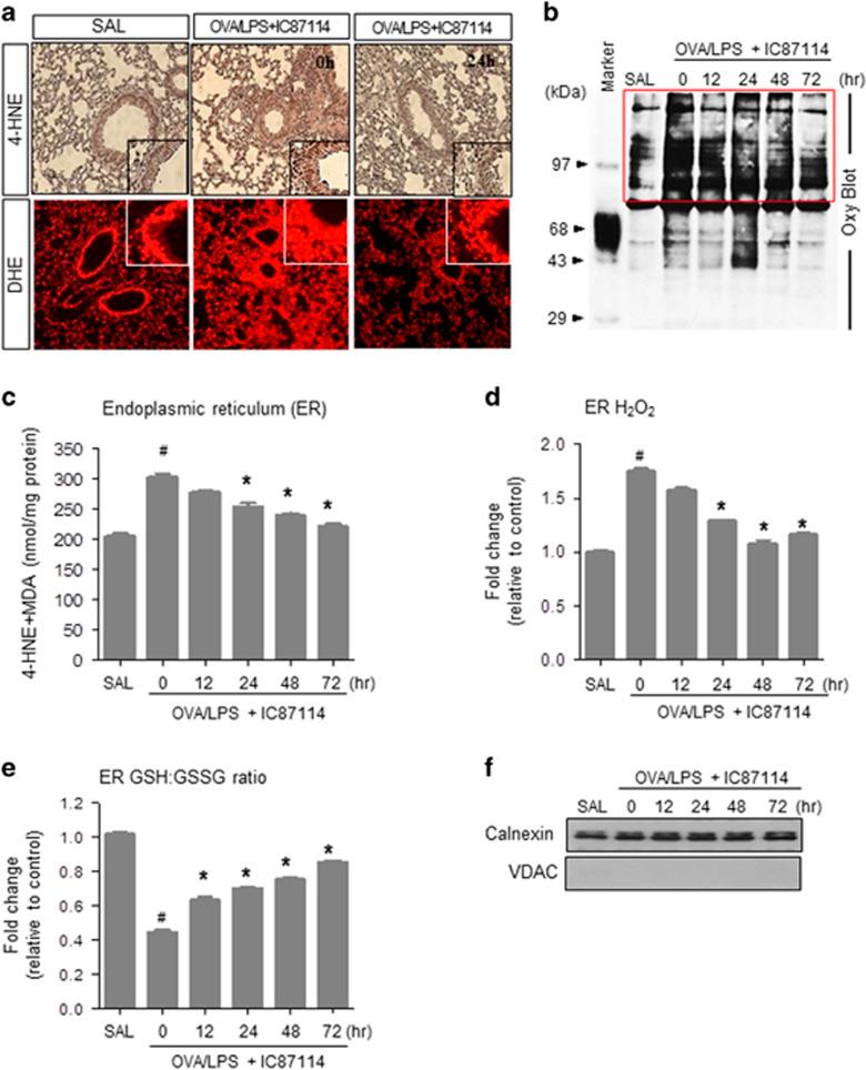 https://cdn.ncbi.nlm.nih.gov/pmc/blobs/52f5/5903822/50b7de156307/emm2017270f3.jpg