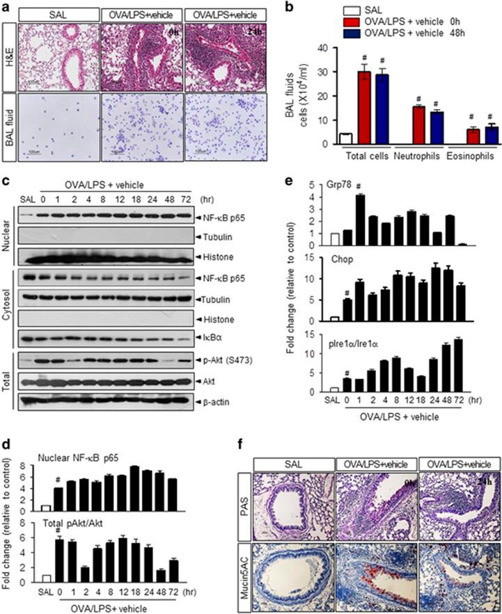 https://cdn.ncbi.nlm.nih.gov/pmc/blobs/52f5/5903822/6b2f16b6306b/emm2017270f1.jpg