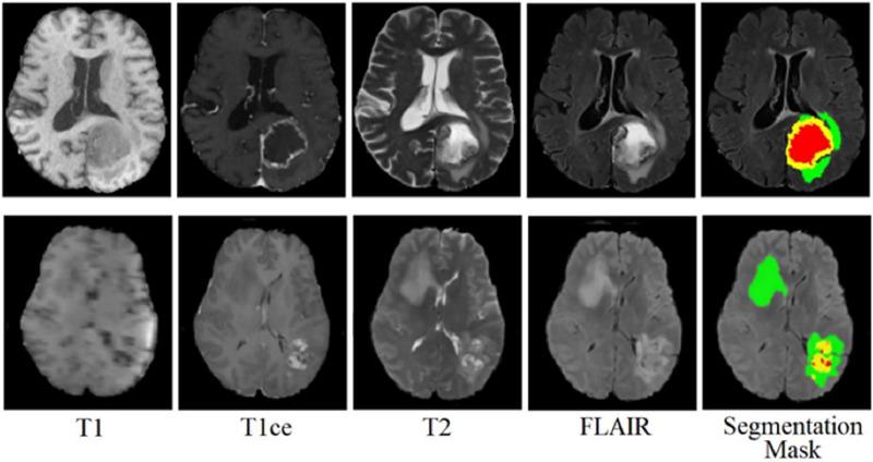 https://cdn.ncbi.nlm.nih.gov/pmc/blobs/52f8/12190573/e6bdc239db23/peerj-cs-11-2787-g003.jpg