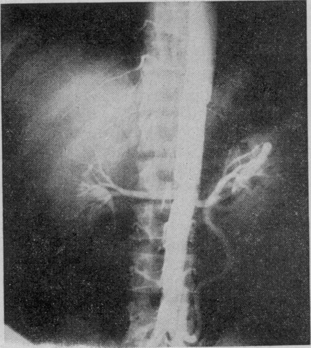 https://cdn.ncbi.nlm.nih.gov/pmc/blobs/52f8/1889221/47b37d552446/procrsmed00378-0040-b.jpg