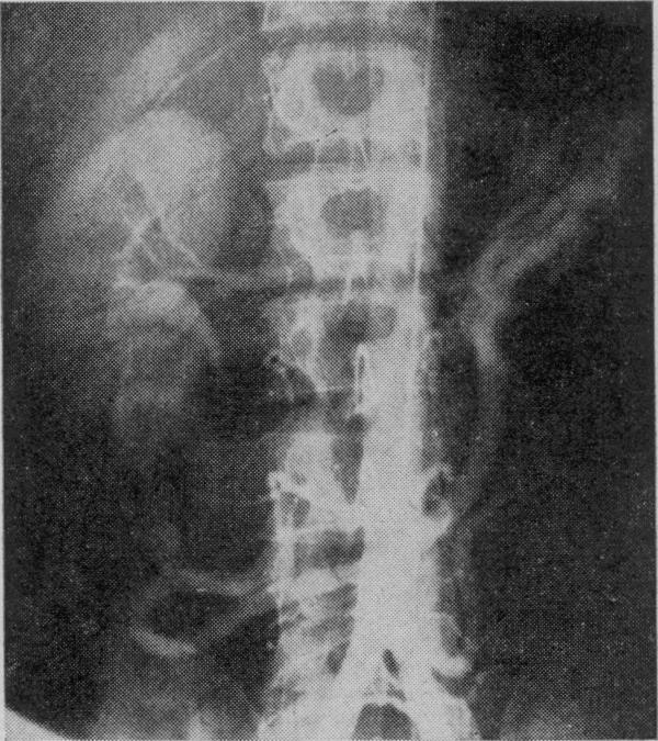 https://cdn.ncbi.nlm.nih.gov/pmc/blobs/52f8/1889221/9d66fca529ed/procrsmed00378-0040-c.jpg