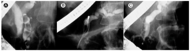 https://cdn.ncbi.nlm.nih.gov/pmc/blobs/52fe/2732774/05e4f7a4a547/kjim-24-169-g003.jpg