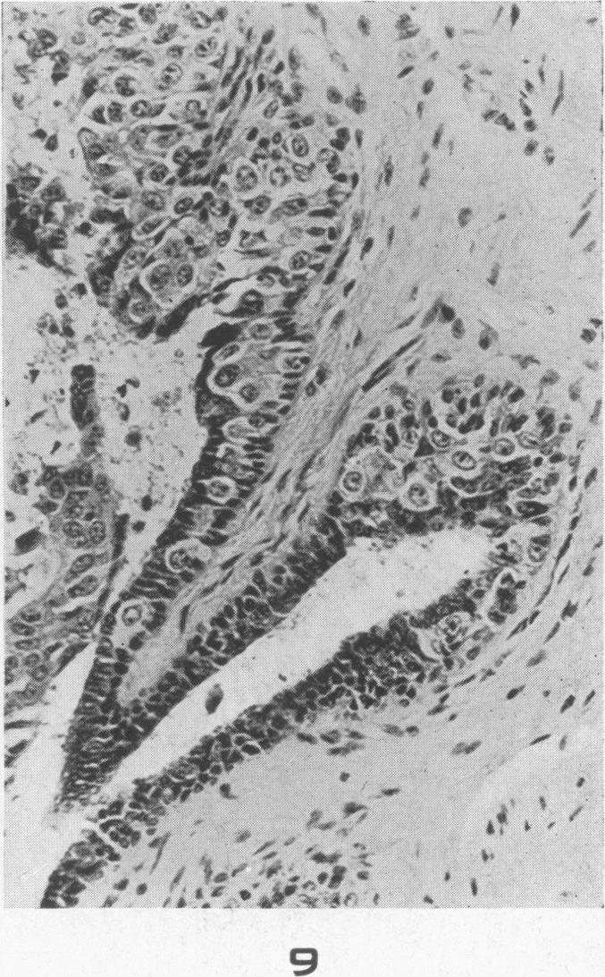https://cdn.ncbi.nlm.nih.gov/pmc/blobs/52ff/1934155/1cb2351ffd40/amjpathol00504-0031-e.jpg
