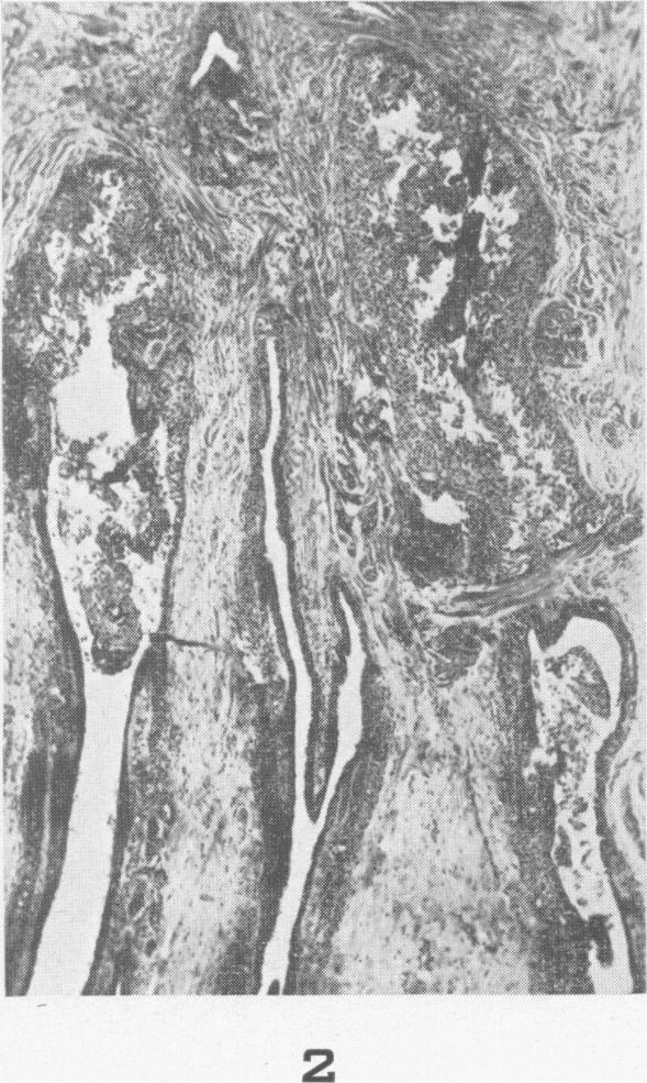 https://cdn.ncbi.nlm.nih.gov/pmc/blobs/52ff/1934155/f52d1d454d4e/amjpathol00504-0029-b.jpg