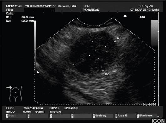 https://cdn.ncbi.nlm.nih.gov/pmc/blobs/5306/4805734/87d5bc321a7c/AnnGastroenterol-29-155-g007.jpg