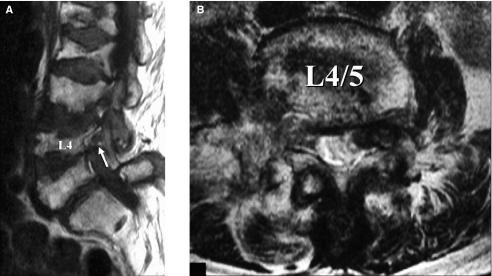https://cdn.ncbi.nlm.nih.gov/pmc/blobs/5307/3078543/c24c7cafc3e6/UPS-0300-9734-116-133_g002.jpg