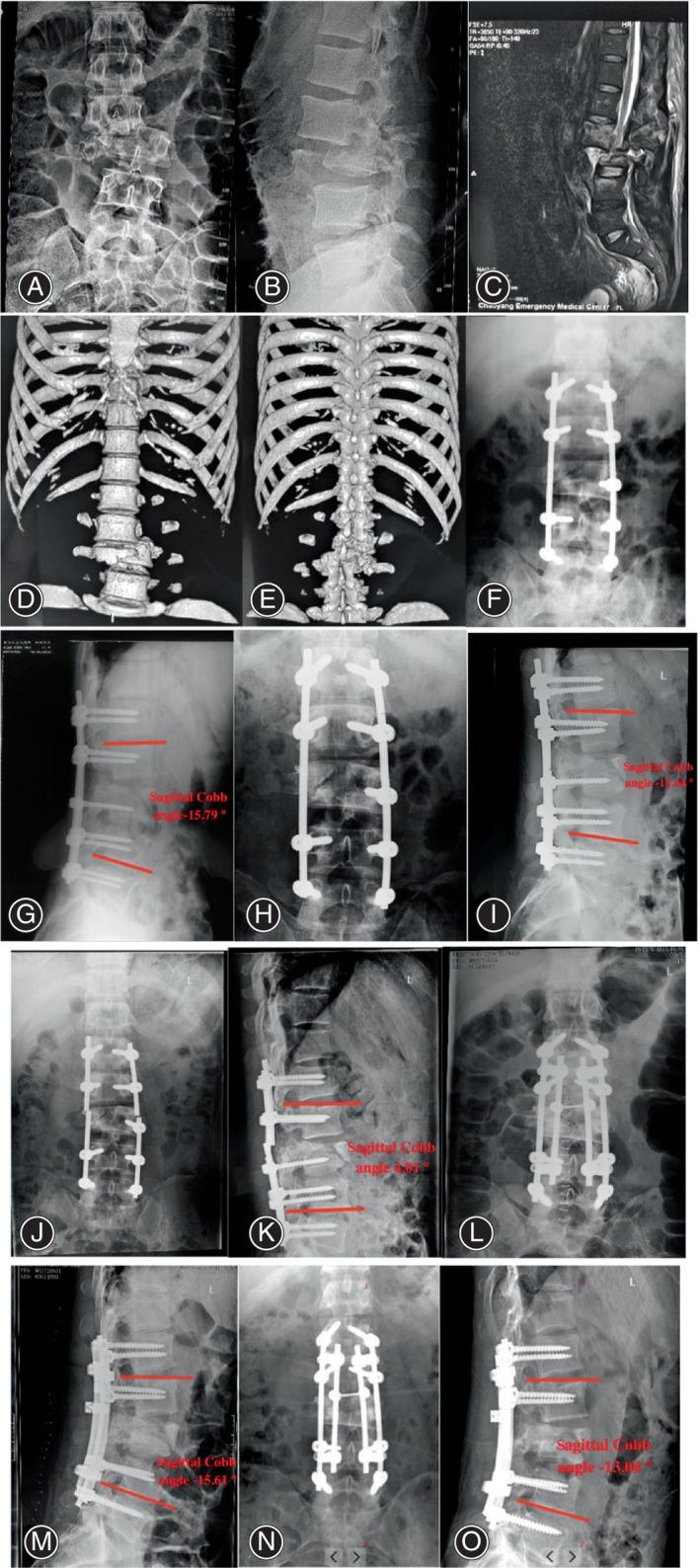 https://cdn.ncbi.nlm.nih.gov/pmc/blobs/5308/11456715/c6fc5bb5fe2a/OS-16-2364-g001.jpg
