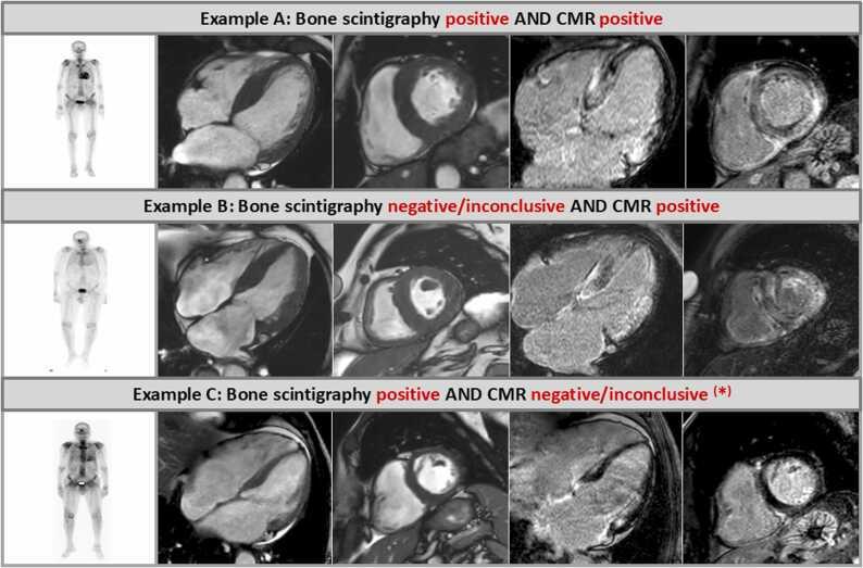 https://cdn.ncbi.nlm.nih.gov/pmc/blobs/530a/11979466/6c78a1ca5e33/gr2.jpg
