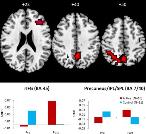 https://cdn.ncbi.nlm.nih.gov/pmc/blobs/530a/6866759/f75f533c0e7e/HBM-38-3190-g004.jpg