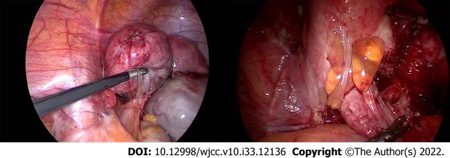 https://cdn.ncbi.nlm.nih.gov/pmc/blobs/5310/9724517/963fabf45dd6/WJCC-10-12136-g002.jpg