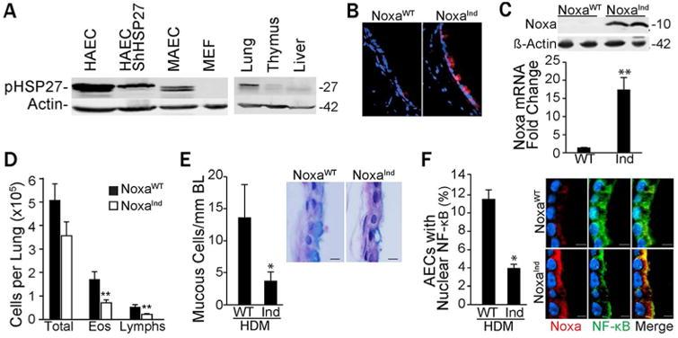 https://cdn.ncbi.nlm.nih.gov/pmc/blobs/5311/5976511/6caf94bd456f/nihms925046f4.jpg