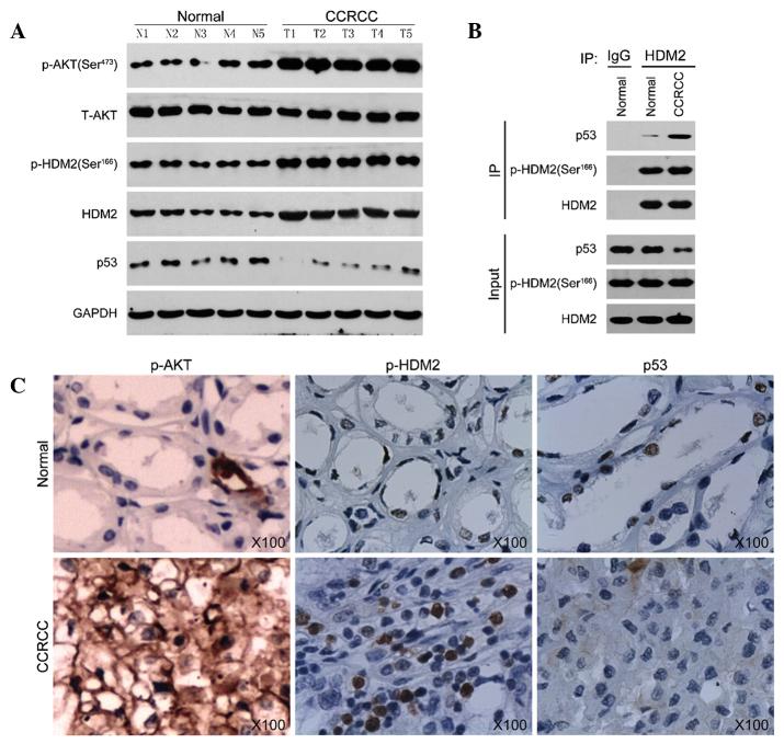 https://cdn.ncbi.nlm.nih.gov/pmc/blobs/5317/4464461/c04a6bf8bad8/MMR-12-02-2622-g03.jpg