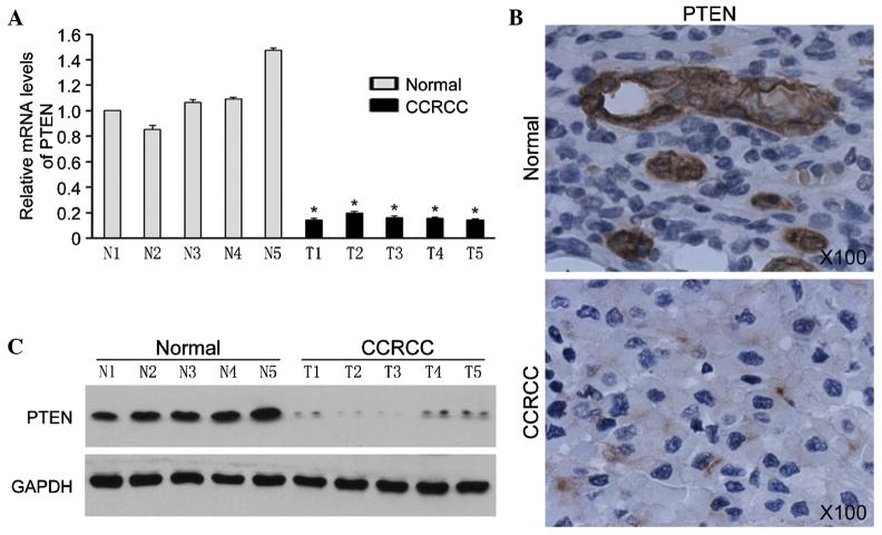 https://cdn.ncbi.nlm.nih.gov/pmc/blobs/5317/4464461/ff4f79cc2258/MMR-12-02-2622-g00.jpg