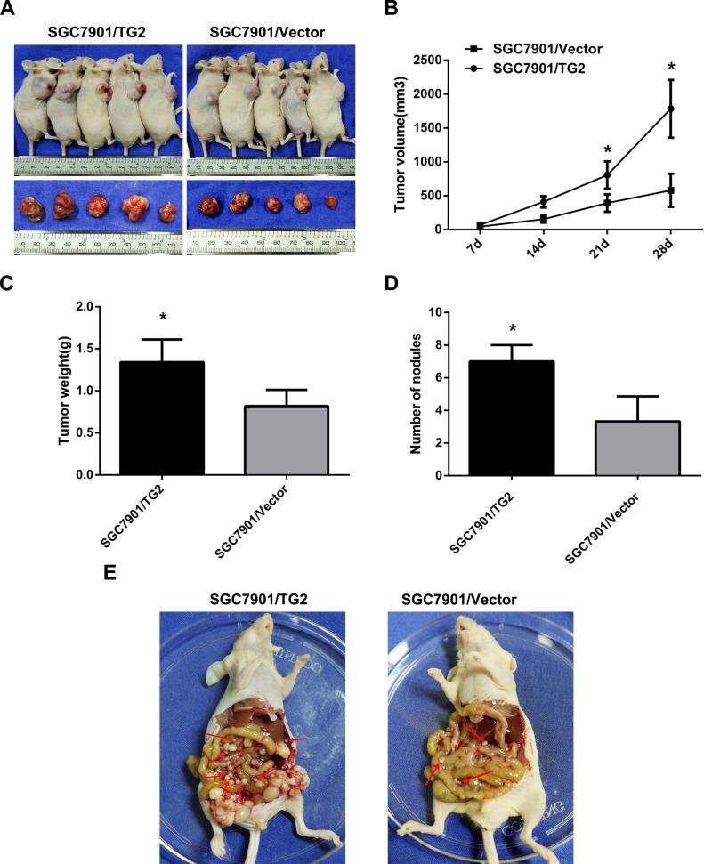 https://cdn.ncbi.nlm.nih.gov/pmc/blobs/5317/4872769/28744c6e4a89/oncotarget-07-7066-g006.jpg