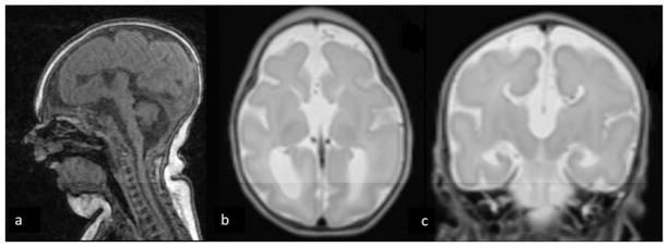 https://cdn.ncbi.nlm.nih.gov/pmc/blobs/531c/6258334/7ece8de5d06a/nihms971419f1.jpg
