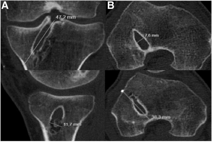 https://cdn.ncbi.nlm.nih.gov/pmc/blobs/5325/11843292/2dccec0412e3/gr2.jpg