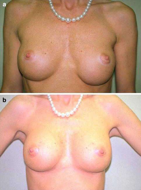 https://cdn.ncbi.nlm.nih.gov/pmc/blobs/5330/2993901/308836a97aa2/266_2010_9510_Fig14_HTML.jpg